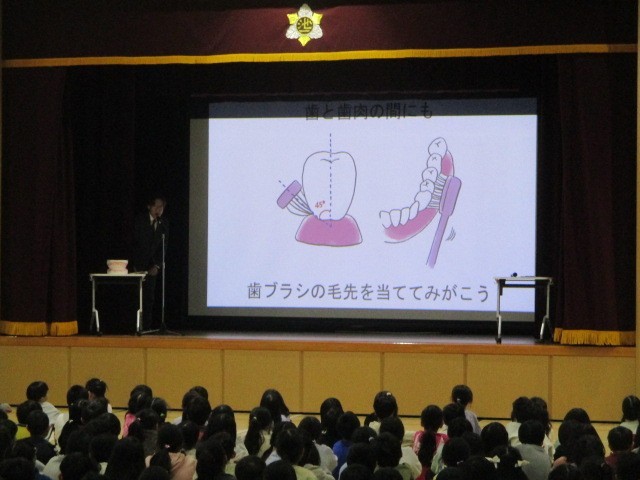 歯科講話２